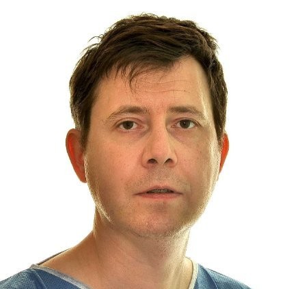 Nicolas NIMESKERN Maxillofacial Surgeon